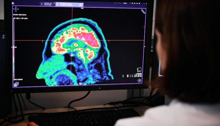 scientists-can-see-suicide-risks-brain-imaging-354